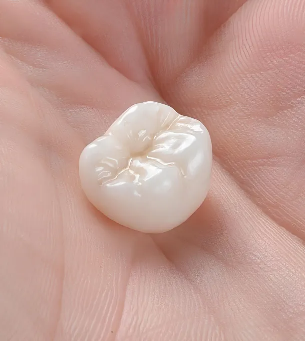 Dental Crowns at Hatfield Cosmetic & Family Dentistry in Greer, South Carolina