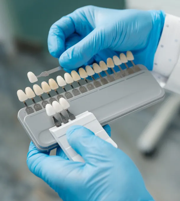 Dental Veneers at Hatfield Cosmetic & Family Dentistry in Greer, South Carolina